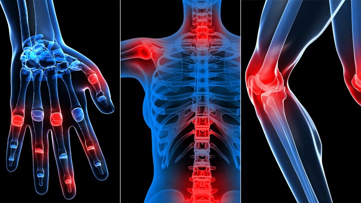 pediatric rheumatologist