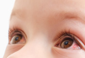 Redness of eyes