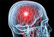 Brain infections